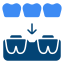 Dental Bridges